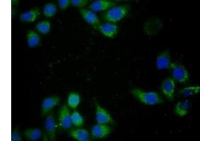 Immunohistochemistry (IHC) image for anti-Cytochrome C, Somatic (CYCS) (AA 5-100) antibody (ABIN7428371)
