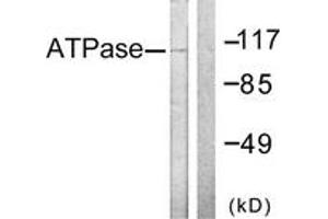 Western blot analysis of extracts from 293 cells, treated with PMA 125ng/ml 30', using ATPase (Ab-16) Antibody. (ATPase antibody  (AA 5-54))