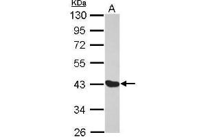 WB Image Sample (30 ug of whole cell lysate) A: MCF-7 10% SDS PAGE antibody diluted at 1:1000 (Melanoma Antigen Family D, 4 (MAGED4) (Center) antibody)