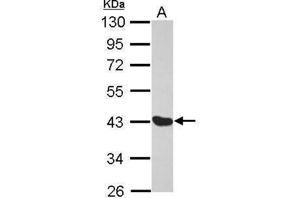 Melanoma Antigen Family D, 4 (MAGED4) (Center) Antikörper