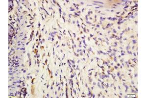 Formalin-fixed and paraffin embedded mouse intestine labeled with Anti-IL-3 Polyclonal Antibody, Unconjugated  at 1:200 followed by conjugation to the secondary antibody and DAB staining. (IL-3 antibody  (AA 101-166))