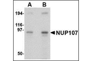 Western blot analysis of NUP107 in A549 cell lysate with this product at (A) 1 and (B) 2 μg/ml. (NUP107 antibody  (Center))