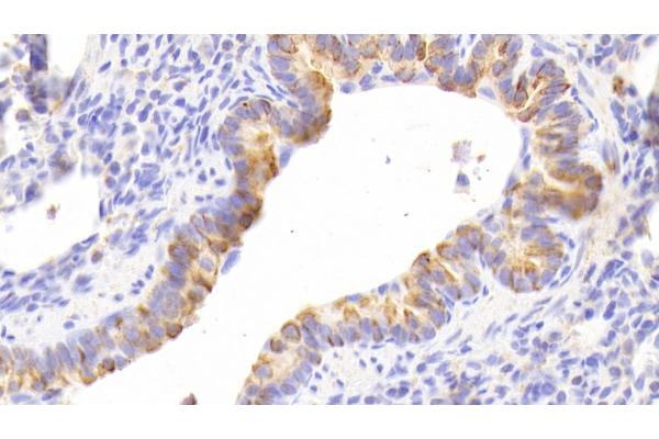 Cytokeratin 13 antibody  (AA 104-403)