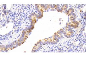 Detection of CK13 in Human Lung Tissue using Polyclonal Antibody to Cytokeratin 13 (CK13) (Cytokeratin 13 antibody  (AA 104-403))