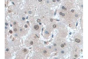 IHC-P analysis of Human Liver Tissue, with DAB staining. (IGF1 antibody  (AA 49-118))