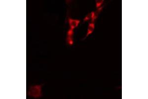 ABIN6278483 staining 293 by IF/ICC. (IL4 Receptor antibody  (N-Term))