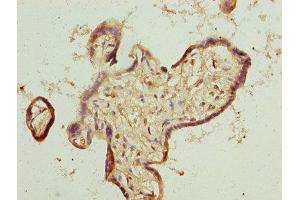Immunohistochemistry of paraffin-embedded human placenta tissue using ABIN7173261 at dilution of 1:100 (TMEM65 antibody  (AA 63-240))