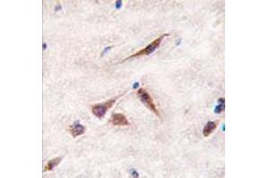 Image no. 1 for anti-ES cell expressed Ras (ERAS) (N-Term) antibody (ABIN356980) (ERAS antibody  (N-Term))