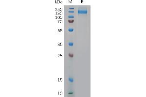 Nucleolin Protein (NCL) (AA 1-711) (His tag)