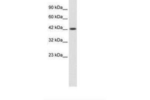 Image no. 1 for anti-Zona Pellucida Glycoprotein 3 (ZP3) (C-Term) antibody (ABIN203127) (Zona Pellucida Glycoprotein 3 antibody  (C-Term))