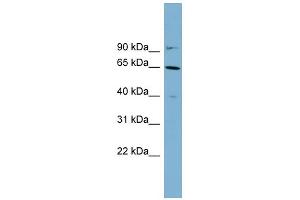 WB Suggested Anti-KRT84 Antibody Titration: 0.