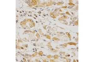 Immunohistochemistry of paraffin-embedded human stomach using OLR1 Antibody (ABIN5970808) at dilution of 1/200 (40x lens). (OLR1 antibody)