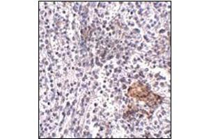 Immunohistochemistry of SHOC2 in human spleen tissue with this product at 5 μg/ml. (SHoc2/Sur8 antibody  (N-Term))