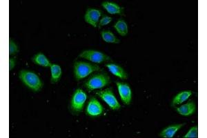 Immunofluorescent analysis of A549 cells using ABIN7163349 at dilution of 1:100 and Alexa Fluor 488-congugated AffiniPure Goat Anti-Rabbit IgG(H+L) (GPX4 antibody  (AA 74-197))