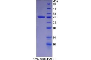 Image no. 1 for Minichromosome Maintenance Deficient 2 (AA 473-679) protein (His tag) (ABIN4988852) (Minichromosome Maintenance Deficient 2 (AA 473-679) protein (His tag))