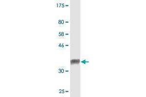 Western Blot detection against Immunogen (33. (SWAP70 antibody  (AA 378-451))