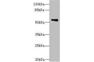 Western blot All lanes: ZSCAN32 antibody at 1 μg/mL + MCF-7 whole cell lysate Secondary Goat polyclonal to rabbit IgG at 1/10000 dilution Predicted band size: 79, 55, 47 kDa Observed band size: 55 kDa (Zinc Finger and SCAN Domain Containing 32 (ZSCAN32) (AA 6-248) antibody)