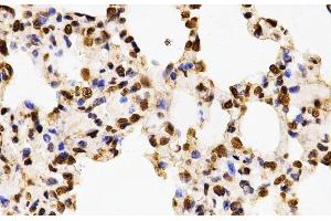 Immunohistochemistry of paraffin-embedded Rat lung using Asymmetric DiMethyl-Histone H3-R17 Polyclonal Antibody at dilution of 1:200 (40x lens). (Histone 3 antibody  (H3R17me2a))