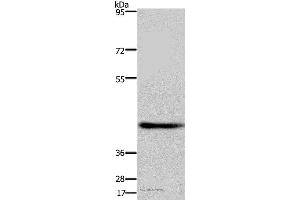 Western blot analysis of Human fetal brain tissue, using DRG1 Polyclonal Antibody at dilution of 1:500