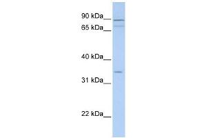 Tenomodulin antibody used at 1 ug/ml to detect target protein. (TNMD antibody  (Middle Region))