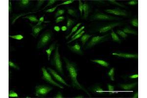 Immunofluorescence of monoclonal antibody to HGD on HeLa cell. (HGD antibody  (AA 377-445))