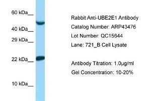 Western Blotting (WB) image for anti-Ubiquitin-Conjugating Enzyme E2E 1 (UBE2E1) (N-Term) antibody (ABIN2781284) (UBE2E1 antibody  (N-Term))