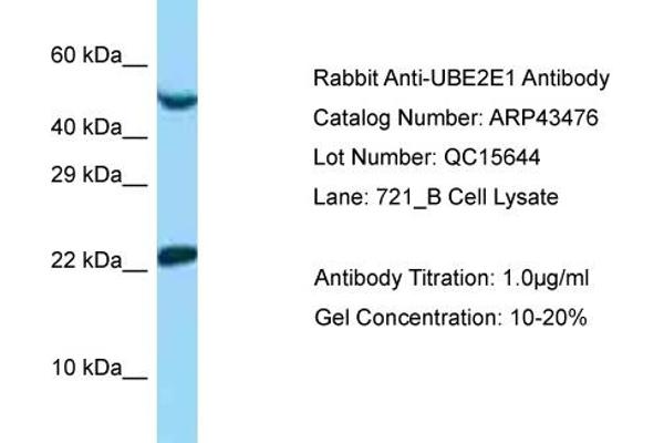 UBE2E1 抗体  (N-Term)