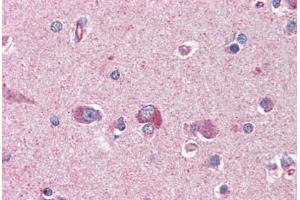 Human Brain, Cortex (formalin-fixed, paraffin-embedded) stained with PAFAH1B1 antibody ABIN364420 at 3. (PAFAH1B1 antibody  (AA 397-410))