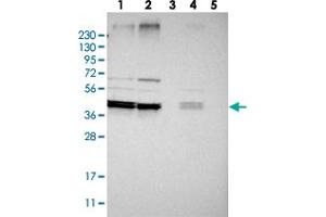 Western blot analysis of Lane 1: RT-4, Lane 2: U-251 MG, Lane 3: Human Plasma, Lane 4: Liver, Lane 5: Tonsil with AUP1 polyclonal antibody . (Ancient Ubiquitous Protein 1 antibody)