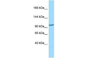 Host: Rabbit Target Name: CCDC66 Sample Type: 293T Whole Cell lysates Antibody Dilution: 1. (CCDC66 antibody  (N-Term))