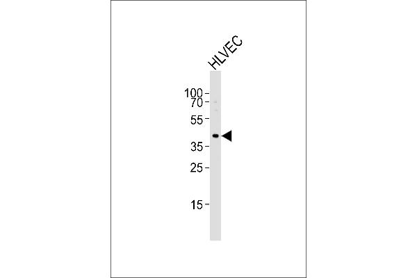 T-Box 1 antibody  (C-Term)