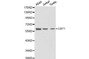 Western blot analysis of extracts of various cell lines, using UAP1 antibody. (UAP1 antibody  (AA 1-290))