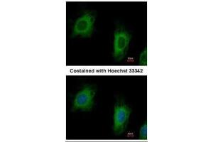 ICC/IF Image Immunofluorescence analysis of paraformaldehyde-fixed HeLa, using TTC1, antibody at 1:500 dilution. (TTC1 antibody)