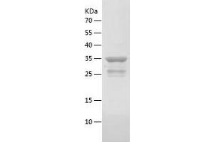 Western Blotting (WB) image for Pro-Gastrin-Releasing Peptide (ProGRP) (AA 24-148) protein (His-IF2DI Tag) (ABIN7283609) (ProGRP Protein (AA 24-148) (His-IF2DI Tag))