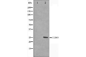 Western blot analysis on A549 cell lysate using Claudin 5 Antibody,The lane on the left is treated with the antigen-specific peptide. (Claudin 5 antibody  (C-Term))