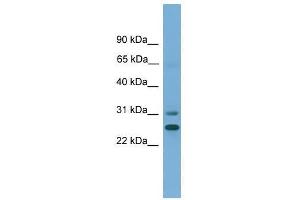 Western Blot showing DHRS2 antibody used at a concentration of 1-2 ug/ml to detect its target protein.