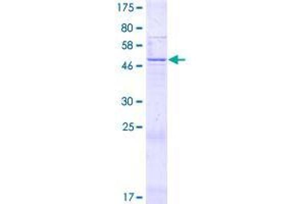 R3HDML Protein (AA 1-253) (GST tag)