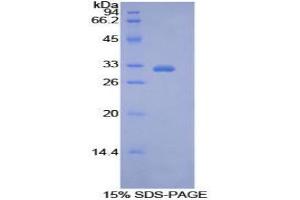 SDS-PAGE analysis of Human PDK4 Protein.