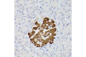 Immunohistochemistry of paraffin-embedded rat pancreatic islet using Insulin Rabbit pAb (ABIN3022884, ABIN3022885, ABIN3022886 and ABIN6219279) at dilution of 1:100 (40x lens).