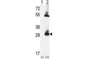 Western blot analysis of TPK1 (arrow) using rabbit polyclonal TPK1 Antibody (N-term) . (TPK1 antibody  (N-Term))