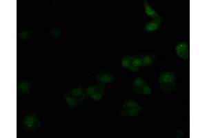 Immunofluorescence staining of HepG2 cells with ABIN7139715 at 1:50, counter-stained with DAPI. (alpha 1 Adrenergic Receptor antibody  (AA 6-22))