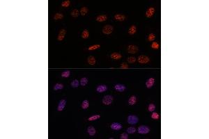 Immunofluorescence (IF) image for anti-Splicing Factor 3b, Subunit 1, 155kDa (SF3B1) (AA 1-144) antibody (ABIN7270543)