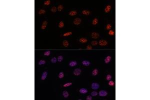 Immunofluorescence analysis of U-2OS using SF3B1 antibody (ABIN7270543) at dilution of d100 (40x lens). (SF3B1 antibody  (AA 1-144))