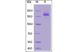 SDS-PAGE (SDS) image for SARS-CoV-2 Spike (Super Stable Trimer) protein (His tag) (ABIN6953302)