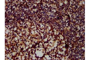IHC image of ABIN6999591 diluted at 1:300 and staining in paraffin-embedded human tonsil tissue performed on a Leica BondTM system. (MX2 antibody  (AA 548-688))