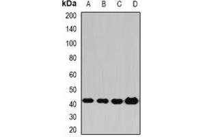 Western blot analysis of PP2C-alpha expression in Hela (A), HepG2 (B), mouse liver (C), rat brain (D) whole cell lysates.