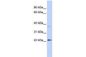 WB Suggested Anti-SRY Antibody Titration:  0. (SRY antibody  (Middle Region))