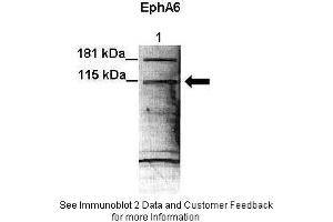 Lanes:  Lane 1: 35ug H4 cell lysate Primary Antibody Dilution:  1:1000 Secondary Antibody:  Anti-rabbit-HRP Secondary Antibody Dilution:  1:5000 Gene Name:  EPHA6 Submitted by:  Erika Mathes Lisabeth, Sanford-Burnham Medical Research Institute (EPH Receptor A6 antibody  (N-Term))