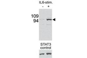 Western blot testing of p-STAT3 antibody and mouse liver tissue/lysate collected before (-) or after (+) stimulation with IL-6 injection in mouse portal vein. (STAT3 antibody  (pSer727))