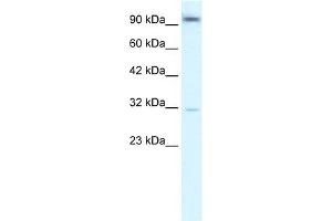 WB Suggested Anti-AHR Antibody Titration:  2.